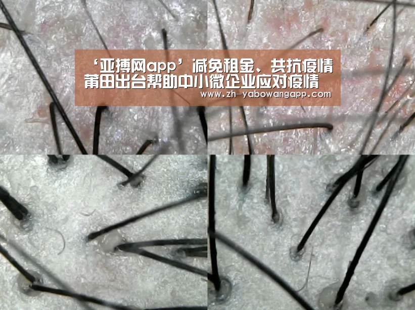 亚搏网app